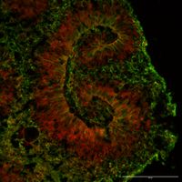 Cortical brain organoid Day35 stained for SIN3A, TUJ1
