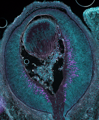 Embryonic mouse eye E15.5 stained for DAPI, TBR2, SIN3A