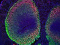 Embryonic mouse prefrontal cortex E14.5 stained for CTIP2, TUJ1, Nissl