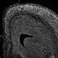 Embryonic mouse prefrontal cortex E15.5 stained for DAPI