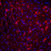 iPSC stained for DAPI, SSEA4